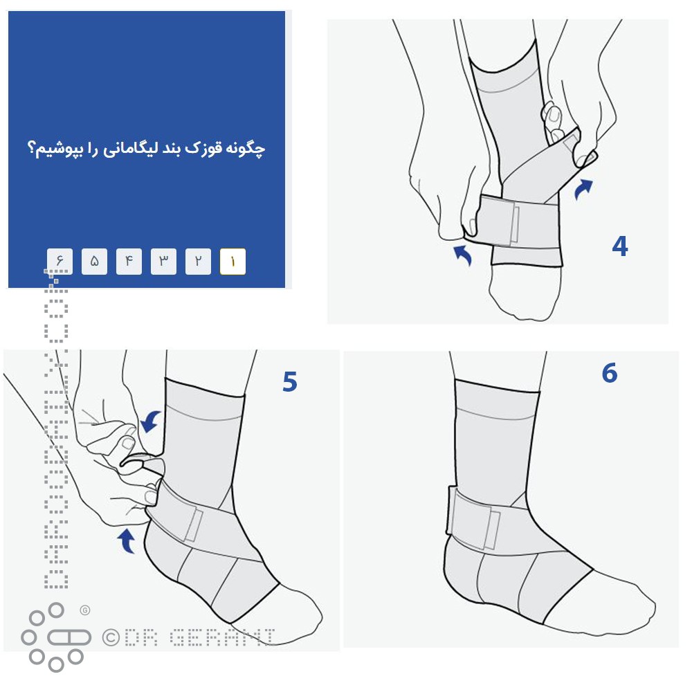 قوزک بند طبی ليگامانی پاک سمن سایز متوسط