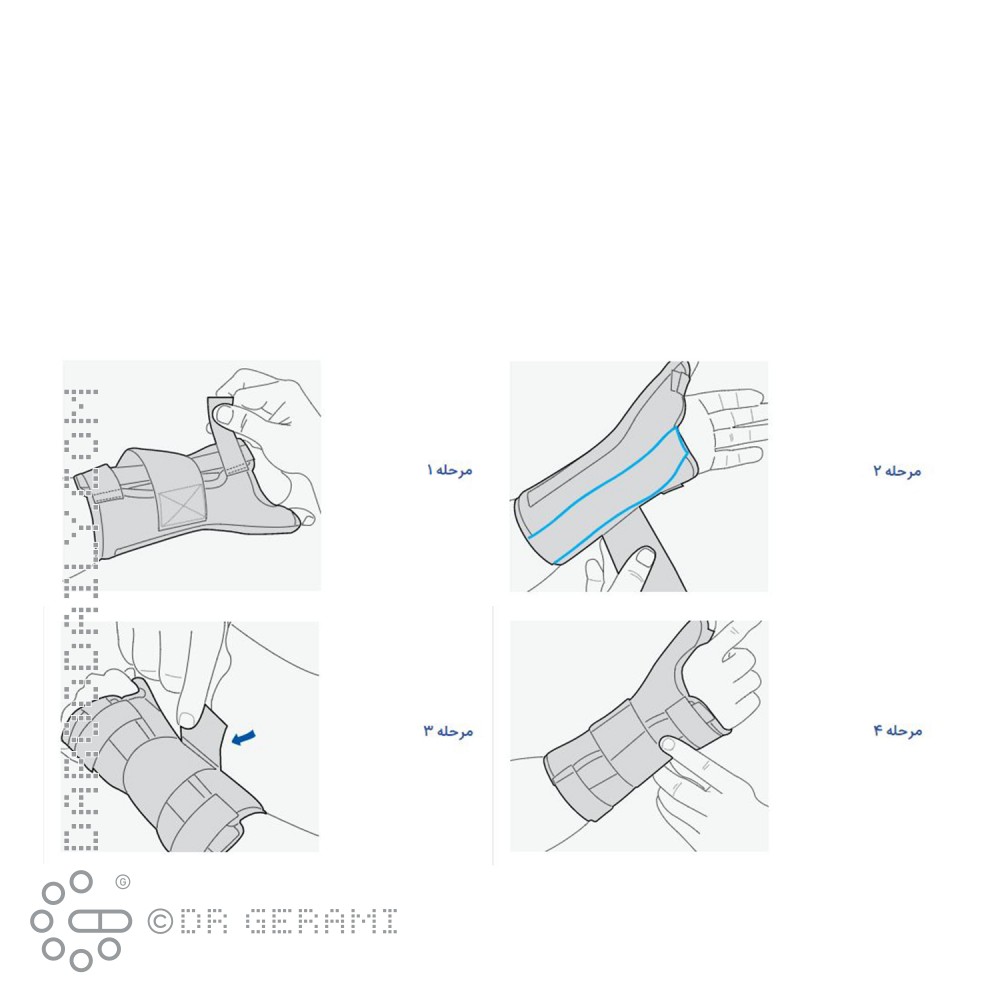 مچ شست بند نئوپرنی آتل دار پاک سمن سایز خیلی بزرگ دست راست