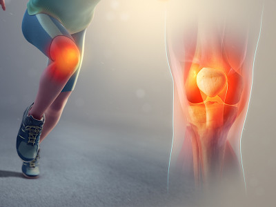 چرا کپسول آلارتریت به یکی از محبوب‌ترین مکمل‌های مفاصل تبدیل شده است؟